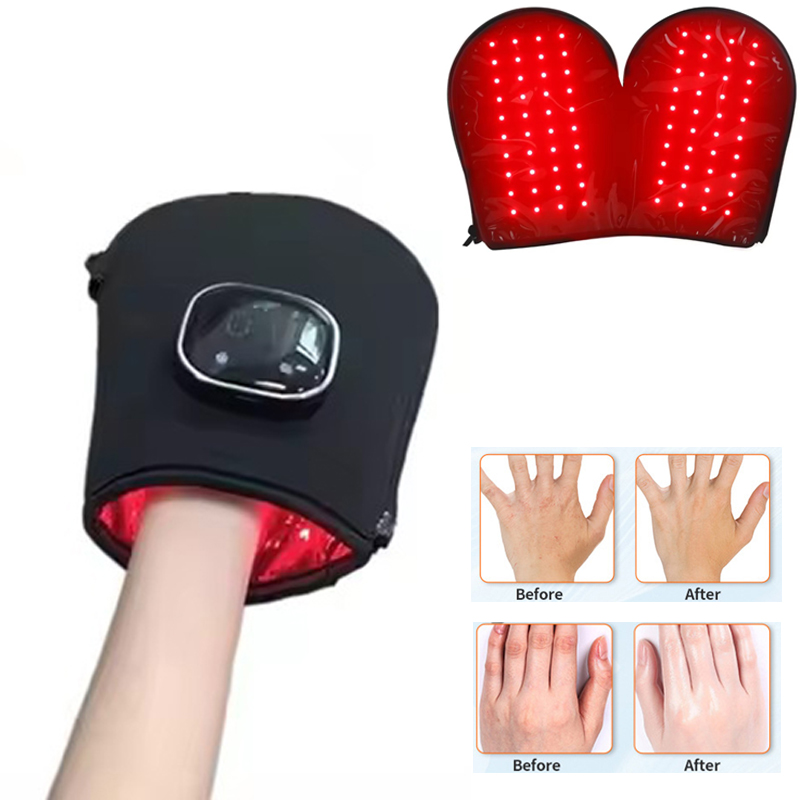 Heated Gloves Electric - อุปกรณ์บำบัดด้วยแสงสีแดงรุ่นใหม่สำหรับมือ ไฟ LED ใกล้รังสีอินฟราเรด บำรุงผิว ชาร์จผ่าน